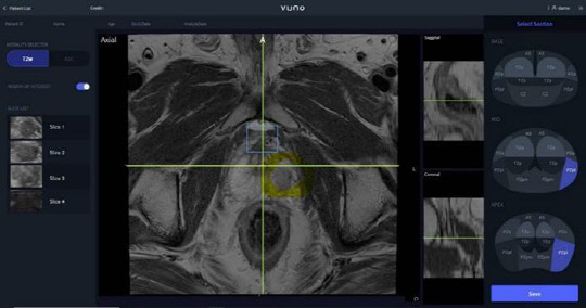 PROMISE- I 스크린샷. 뷰노 제공
